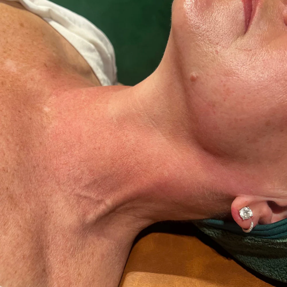 Boxing Day Sale - Treatments